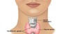 Comprehensive Thyroid Profile - Complete Thyroid Profile