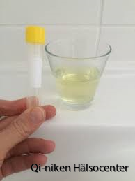 urinprov