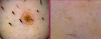 Digital Microscope Skin HairScalp Hud Diagnos