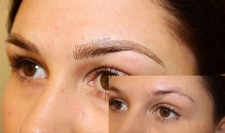 dermacell göteborg omdöme dermacell göteborg omdöme
