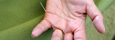 Akupunktör Halmstad nålar hand akupunktur Halland