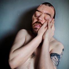 Daryl has a rare condition called Pfeiffer syndrome, which affects the development of the skull. He spent much of his childhood in hospitals and has undergone nearly 250 surgeries. He faces prejudice 