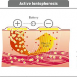IONTOFORES