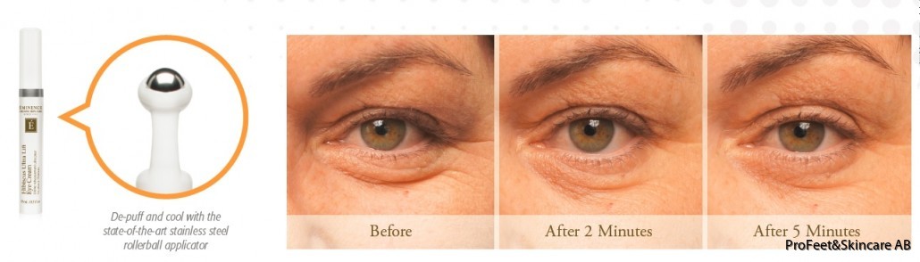 Before-After-Hibiscus-Eye-Cream-11-1030x294