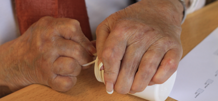 Image description: A rheumatic person's hands trying to open a white pill bottle. Image description: A rheumatic person's hands trying to open a white pill bottle.