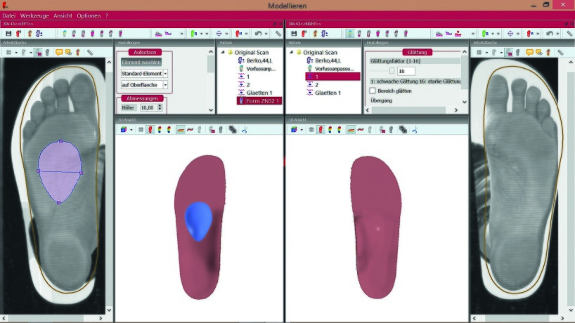 Customized analyserar, CAD:ar och modellerar färdigt skoinläggen