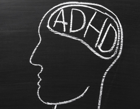 Medicinering med metylfenidat vid adhd tycks påverka hjärnans vita substans. Medicinering med metylfenidat vid adhd tycks påverka hjärnans vita substans.