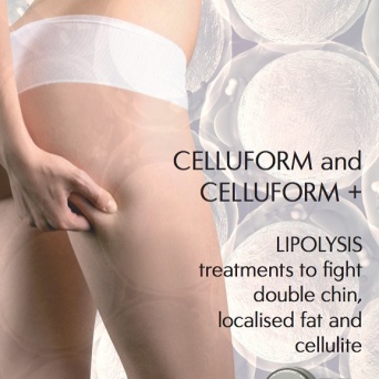 Fettreducering med Celluform Fettreducering med Celluform