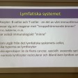 Lymfom -09