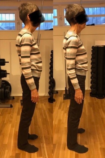Före & efter 3 övnigar som tog bara 4 min Före & efter 3 övnigar som tog bara 4 min