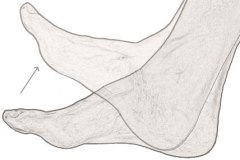 Dorsalflexion - "Förmågan att peka tårna mot taket" Bild hämtad från: http://www.orthoticshop.com/orthotic-adjustments-foot-biomechanics.html Dorsalflexion - "Förmågan att peka tårna mot taket" Bild hämtad från: http://www.orthoticshop.com/orthotic-adjustments-foot-biomechanics.html