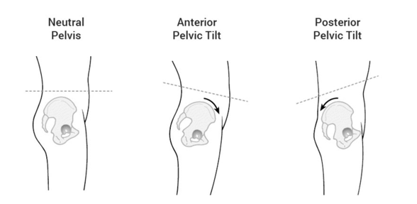 Till vänster: Neutral position. I mitten: Framåttippat (svank). Till höger: Bakåttippat (mindre svank) Till vänster: Neutral position. I mitten: Framåttippat (svank). Till höger: Bakåttippat (mindre svank)